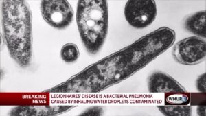 Lincoln outbreak: What is Legionnaires' disease?